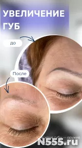 Удаление перманентного макияжа