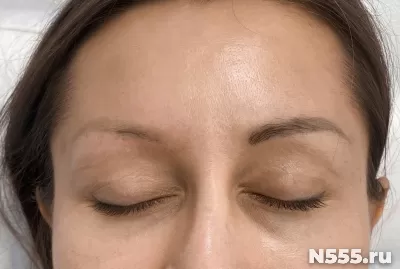 Удаление татуажа